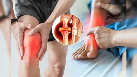 Περιοχές δέρματος κατάλληλες για την εφαρμογή Icexin gel (γόνατα, αγκώνες, κάτω μέρος της πλάτης)